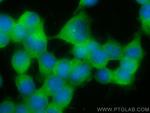 GLAST Antibody in Immunocytochemistry (ICC/IF)