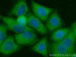 WDR55 Antibody in Immunocytochemistry (ICC/IF)