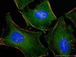 Caldesmon Antibody in Immunocytochemistry (ICC/IF)