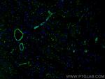 Caldesmon Antibody in Immunohistochemistry (PFA fixed) (IHC (PFA))