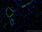 Caldesmon Antibody in Immunohistochemistry (PFA fixed) (IHC (PFA))