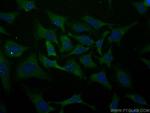 PML Antibody in Immunocytochemistry (ICC/IF)