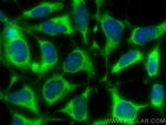 UBXD2 Antibody in Immunocytochemistry (ICC/IF)