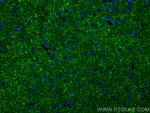 Synaptopodin Antibody in Immunohistochemistry (PFA fixed) (IHC (PFA))
