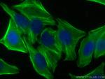 CNN2 Antibody in Immunocytochemistry (ICC/IF)