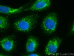 CHCHD4 Antibody in Immunocytochemistry (ICC/IF)