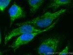 CHCHD4 Antibody in Immunocytochemistry (ICC/IF)