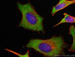 SH3BGR Antibody in Immunocytochemistry (ICC/IF)
