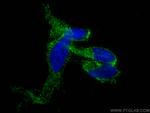 LRPPRC Antibody in Immunocytochemistry (ICC/IF)