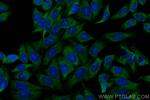 C5aR Antibody in Immunocytochemistry (ICC/IF)