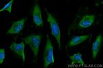 C3/C3b/C3c Antibody in Immunocytochemistry (ICC/IF)