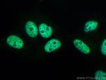 SR140 Antibody in Immunocytochemistry (ICC/IF)