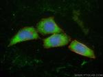 MYH10 Antibody in Immunocytochemistry (ICC/IF)