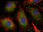 SMMHC Antibody in Immunocytochemistry (ICC/IF)