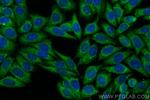 LRRC8C Antibody in Immunocytochemistry (ICC/IF)