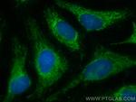 MRPL28 Antibody in Immunocytochemistry (ICC/IF)