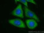 KIF5B Antibody in Immunocytochemistry (ICC/IF)
