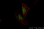 GBX2 Antibody in Immunocytochemistry (ICC/IF)