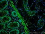 MYLK Antibody in Immunohistochemistry (Paraffin) (IHC (P))