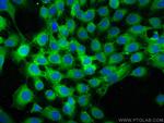 Integrin Beta 4 Antibody in Immunocytochemistry (ICC/IF)