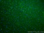 L-VOCC Antibody in Immunohistochemistry (PFA fixed) (IHC (PFA))