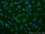 Ataxin 2 Antibody in Immunohistochemistry (PFA fixed) (IHC (PFA))