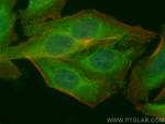 NR3C2 Antibody in Immunocytochemistry (ICC/IF)
