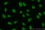 SAFB Antibody in Immunocytochemistry (ICC/IF)