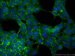 DSG2 Antibody in Immunocytochemistry (ICC/IF)