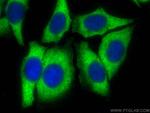 Sclerostin Antibody in Immunocytochemistry (ICC/IF)