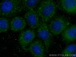 FUT4 Antibody in Immunocytochemistry (ICC/IF)