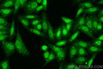 YY1 Antibody in Immunocytochemistry (ICC/IF)