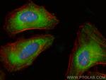 HIP1 Antibody in Immunocytochemistry (ICC/IF)