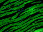 MYH6 Antibody in Immunohistochemistry (PFA fixed) (IHC (PFA))