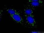 DCP1A Antibody in Immunocytochemistry (ICC/IF)