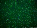DAT Antibody in Immunohistochemistry (PFA fixed) (IHC (PFA))