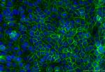 MCT4 Antibody in Immunocytochemistry (ICC/IF)