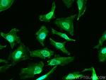 PHLPP Antibody in Immunocytochemistry (ICC/IF)