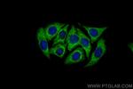 CCS Antibody in Immunocytochemistry (ICC/IF)