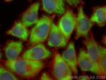 IGF2BP1 Antibody in Immunocytochemistry (ICC/IF)
