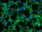 KCNN4 Antibody in Immunocytochemistry (ICC/IF)