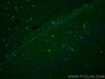 PINK1 Antibody in Immunohistochemistry (PFA fixed) (IHC (PFA))