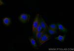 UPF1 Antibody in Immunocytochemistry (ICC/IF)