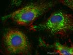 KGA/GAM/GAC Antibody in Immunocytochemistry (ICC/IF)