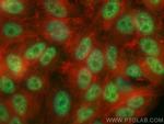 P15RS Antibody in Immunocytochemistry (ICC/IF)