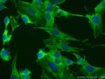 Alpha Actin Antibody in Immunocytochemistry (ICC/IF)