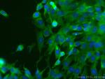 Alpha Actin Antibody in Immunocytochemistry (ICC/IF)
