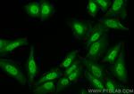 BCL3 Antibody in Immunocytochemistry (ICC/IF)