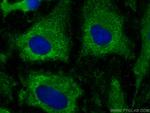 Angiotensinogen Antibody in Immunocytochemistry (ICC/IF)
