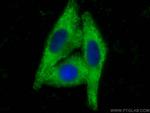Angiotensinogen Antibody in Immunocytochemistry (ICC/IF)